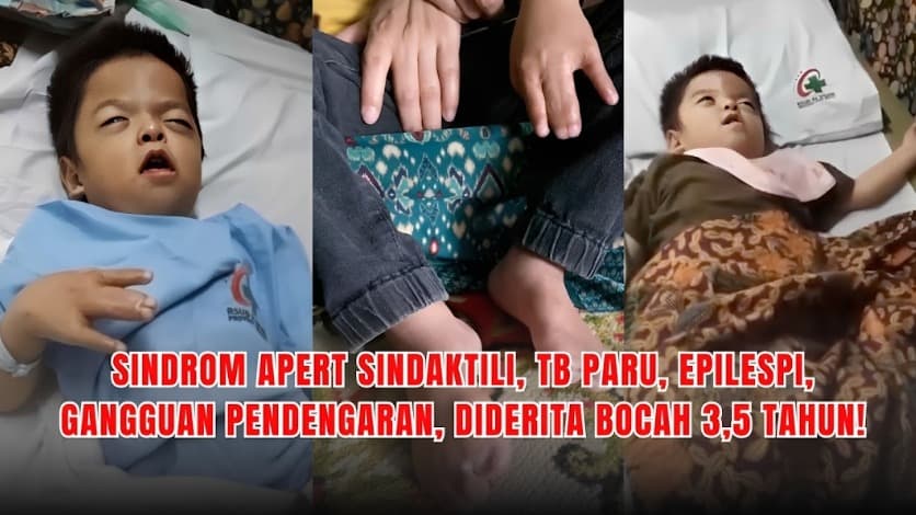 TOLONG Salman Idap Penyakit Langka dan Berbahaya
